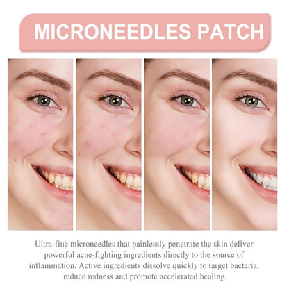 Derma Smooth Skin Tag Removal Patch | Secret To Spotless Skin